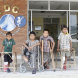 disabilities, nepal, children, club foot