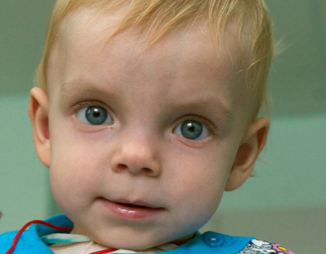 Young Russian patient with congenital heart defect